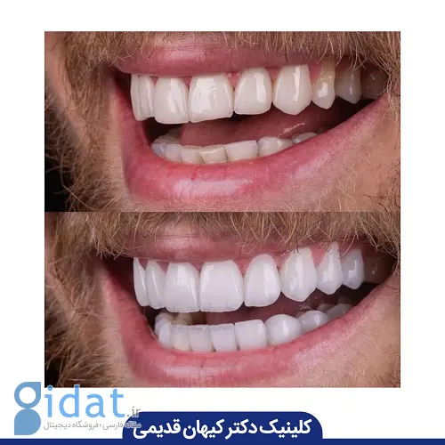 متخصص کامپوزیت دندان چه ویژگی‌هایی دارد؟